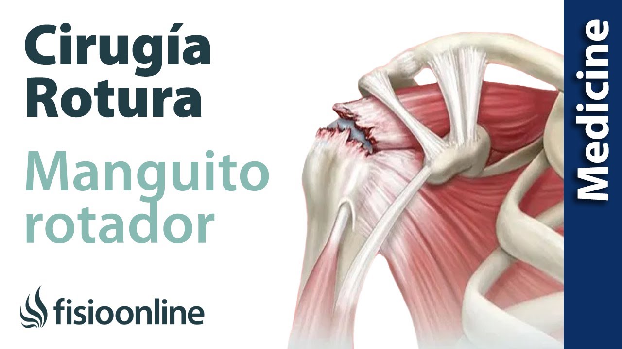 Incapacidad permanente por omalgia: Causas y soluciones