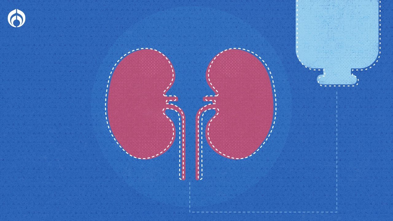 Pensión por falta de riñón: ¿Cómo solicitarla? Pensión por falta de riñón: ¿Cómo solicitarla?