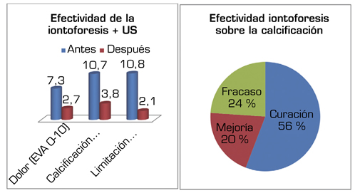 Tendinitis calcificante de hombro: causas y baja laboral Tendinitis calcificante de hombro: causas y baja laboral